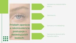 Infografika znázorňujúca priebeh úspešnej operácie očí Esmeraldy