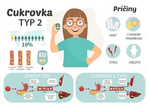 Infografika zobrazujúca rôzne typy svadobných filmov