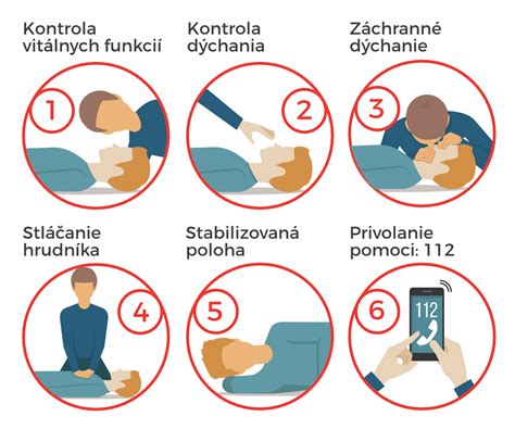 Infografika zobrazujúca správne kroky pri poskytovaní prvej pomoci pri zlomenine končatiny.