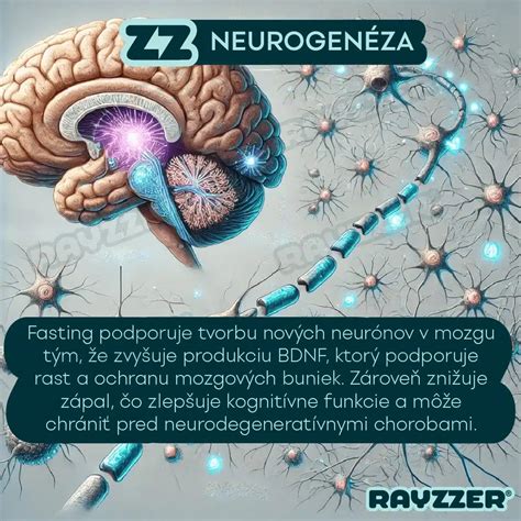 Infografika: Aktivita mozgu pri vianočných podnetoch u ľudí s 