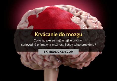 Infografika: Krvácanie do mozgu a jeho následky