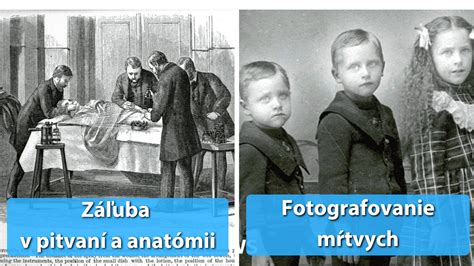 Historická post-mortem fotografia z viktoriánskej éry