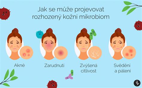 infografika: kroky prípravy pokožky pred holením