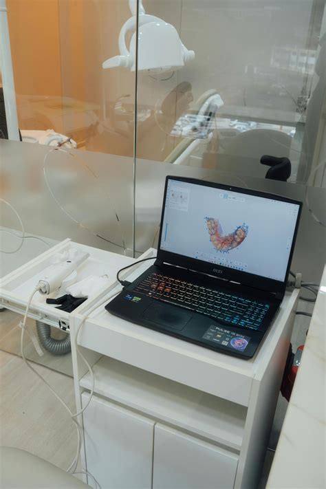 Ilustrácia otvárania vianočného crackera dvoma ľuďmi a jeho obsahu