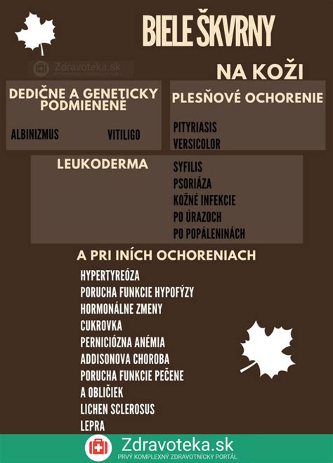 Infografika: Zhrnutie typov poľovných lístkov a ich platnosti