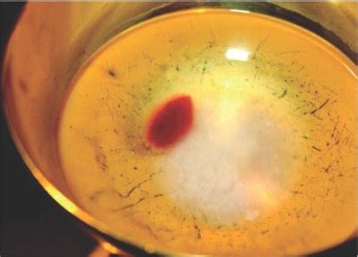 Reprodukcia fresky Raffaella Sanzia „Omša v Bolsene“ zobrazujúca eucharistický zázrak