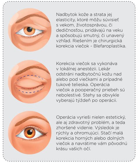 infografika znázorňujúca frekvenciu očných vyšetrení u detí v rôznych vekových obdobiach
