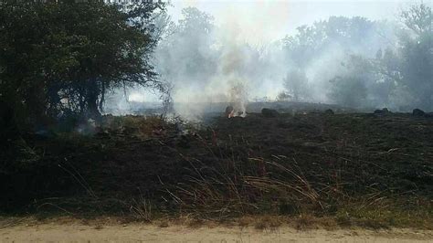 osoba s popáleninami
