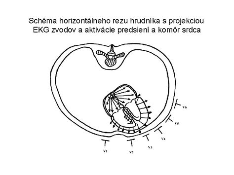 Schéma rezu a tvarovania korunky enciánového stromčeka pre zabezpečenie hustoty a bohatého kvitnutia