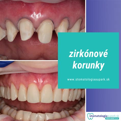 Ukážka svadobných doplnkov ako sú korunky a bižutéria