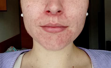 Návod na upírsky make-up s bledou pleťou a stopami krvi