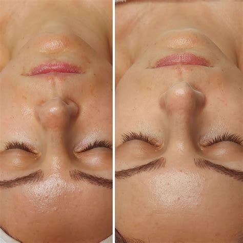 Fotografia ihličnatého venca pred a po ošetrení sprejom